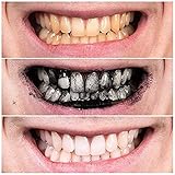 Zahnaufhellung Zähne Pulver,Natürliche Kokosnuss Aktivkohle Zahnpulver für Frischen Sie den Atem und entfernen Sie schnell Zahnstein/Zahnflecken - 4
